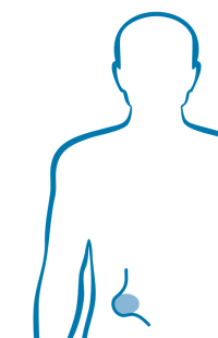 Hernien